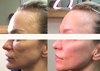 Henderson Med Spa Advanced Aesthetics Henderson