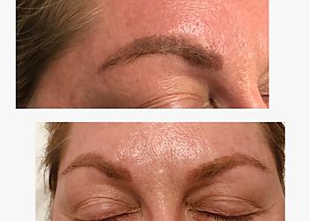 Tacoma Med Spa Advanced Laser Clinic & MedSpa