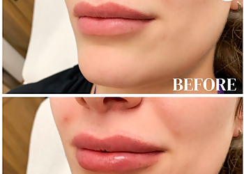 Tacoma Med Spa Advanced Laser Clinic & MedSpa