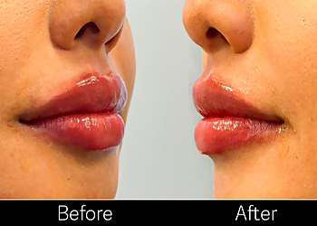 Pasadena Med Spa Ajliss Medical Aesthetics