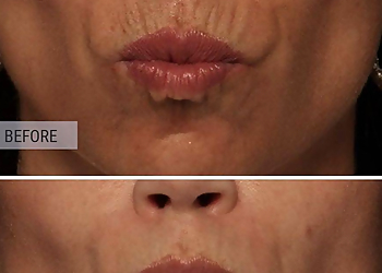 Anchorage Med Spa Alaska Body Aesthetics LLC