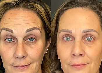 Fayetteville Med Spa Allure Aesthetics & Medical Spa