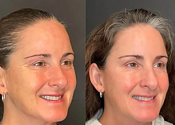 Fayetteville Med Spa Allure Aesthetics & Medical Spa