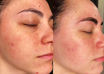 Tempe Med Spa Allure Infinite Beauty