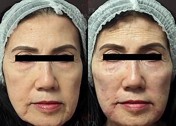 Irvine Med Spa Amoderm Cosmetic and Wellness Medical Center