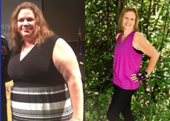 Anchorage Weight Loss Centers Anchorage Bariatrics