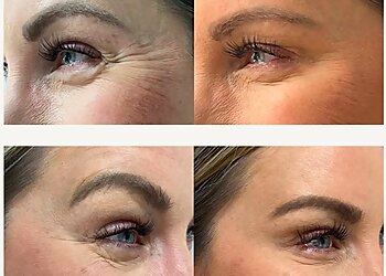 Salinas Spas Aquablue Skin & Body Spa