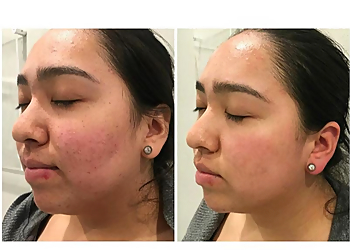 Fremont Med Spa Ariba Medical Spa