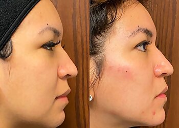 Omaha Med Spa Bare Body Shop