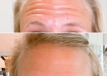 Wilmington Med Spa Beach Medical Aesthetics