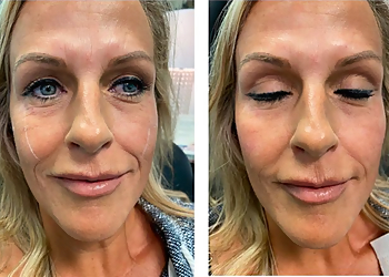 Lexington Med Spa Beautiful You Medical Spa