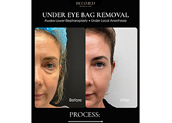 Beiamed Medspa & Clinic - Miami, FL Med Spas - Before and After Image