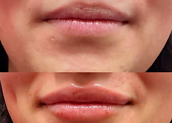 Denton Med Spa Beleza MedSpa