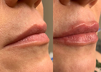 Denton Med Spa Beleza MedSpa