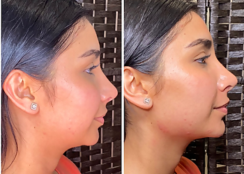 Brownsville Med Spa Bella Bar Medspa