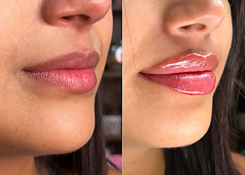 Brownsville Med Spa Bella Bar Medspa