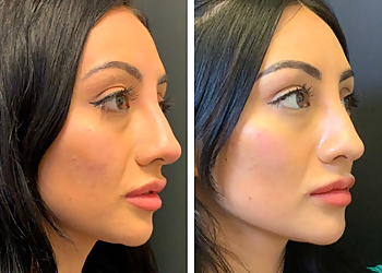 Orange Med Spa Bellatudo Skin and Wellness Center