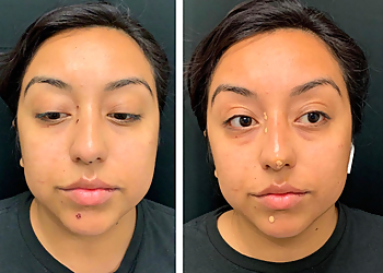 Orange Med Spa Bellatudo Skin and Wellness Center