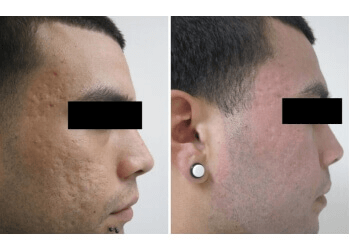 Los Angeles Dermatologists Ben Behnam, MD, FAAD - DERMATOLOGY & HAIR RESTORATION SPECIALISTS INC.