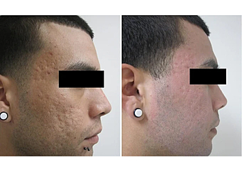 Los Angeles Dermatologists Ben Behnam, MD, FAAD - DERMATOLOGY & HAIR RESTORATION SPECIALISTS INC.