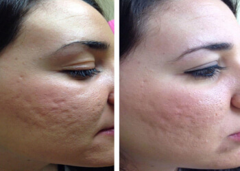 3 Best Med Spa in Frisco, TX - ThreeBestRated