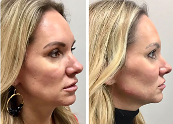 Frisco Med Spa Beverly Hills Rejuvenation Center Frisco