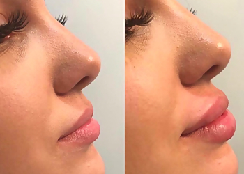 West Palm Beach Med Spa Beverly Hills Wellness Center & Med Spa