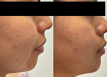 Garland Med Spa Biorejuvenate