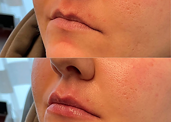 Seattle Med Spa Blue Haven Medical Spa