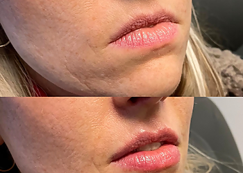 Seattle Med Spa Blue Haven Medical Spa