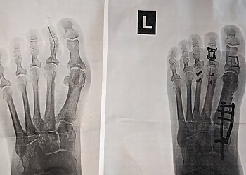 Lakewood Podiatrists Brett D. Sachs, DPM, FACFAS - ROCKY MOUNTAIN FOOT & ANKLE CENTER