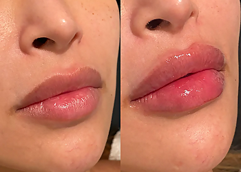 Corona Med Spa California Cosmetics