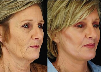 Waco Plastic Surgeon Charles Guy, DO - FACIAL PLASTIC SURGERY OF CENTRAL TEXAS