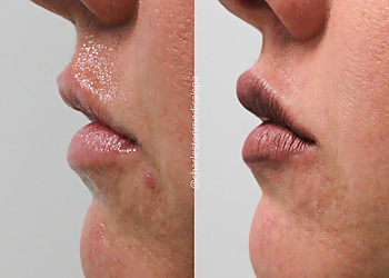 Charleston Med Spa Charleston Medical Spa