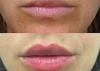 Charleston Med Spa Charleston Medical Spa