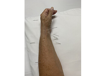 Chesapeake Acupuncture Chesapeake Chinese Acupuncture