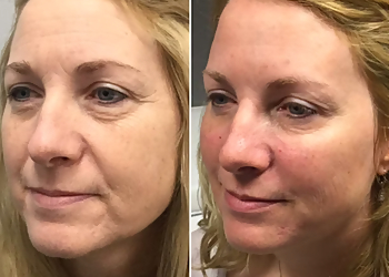 Columbus Med Spa Columbus Medical Aesthetics