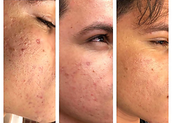 Boston Med Spa Cosmetic & Laser Center