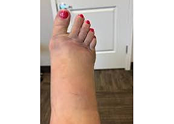DR. Kelly L. Hamblin, DPM - West Jordan, UT Podiatrists - Patient Care Image
