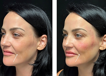 Oceanside Med Spa Dermacare