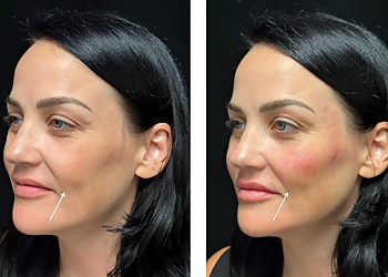 Carlsbad Med Spa Dermacare Medical Aesthetics Carlsbad