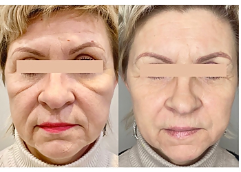 Jersey City Med Spa Downtown Medspa