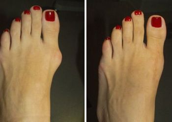 Dallas Podiatrists Kennedy Legel, DPM - ADVANCED FOOT & ANKLE CARE SPECIALISTS