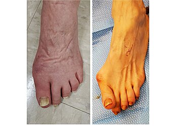 San Diego Podiatrists Dr. Philip Wrotslavsky, DPM - ADVANCED FOOT AND ANKLE CENTER