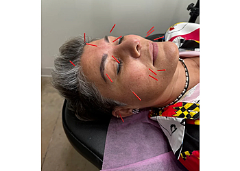 McAllen Acupuncture Dynamic Healing Acupuncture