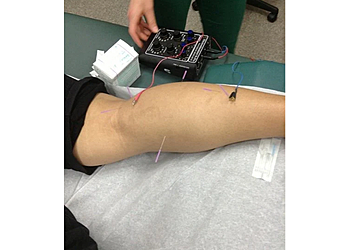 McAllen Acupuncture Dynamic Healing Acupuncture