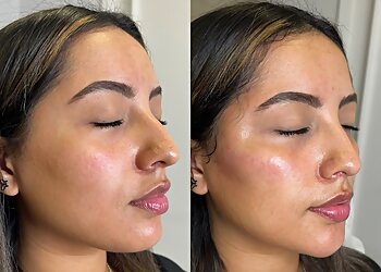 Atlanta Med Spa Ecobel Med Spa