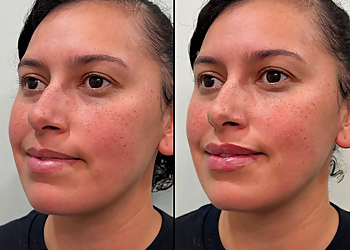 Fayetteville Med Spa Elan Med Spa