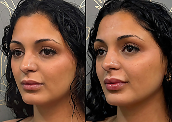 Fayetteville Med Spa Elan Med Spa