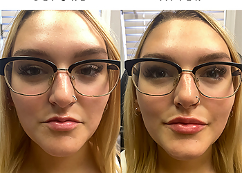 Toledo Med Spa Elite Beauty Medical Aesthetics